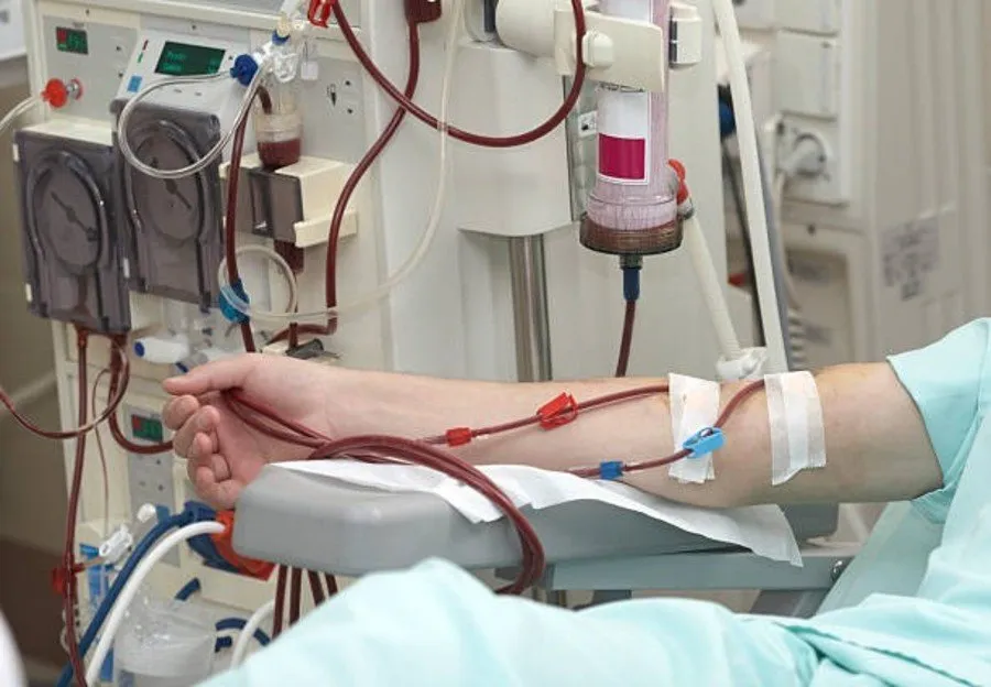 free dialysis in Rajkot 2.jpg