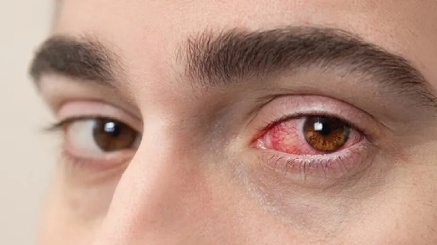 eyes.jpg