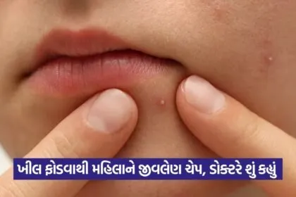 pimple 1408