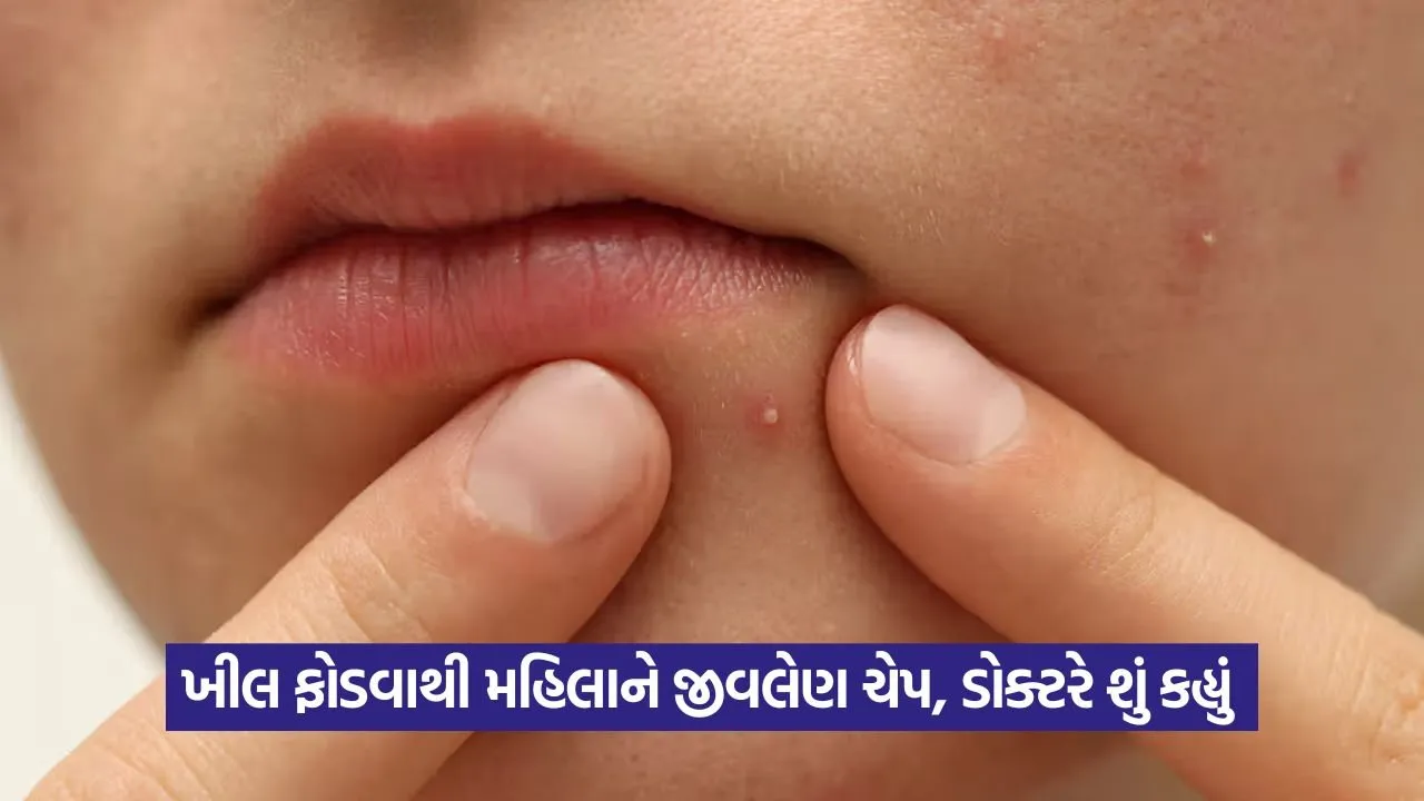 pimple 1408.jpg