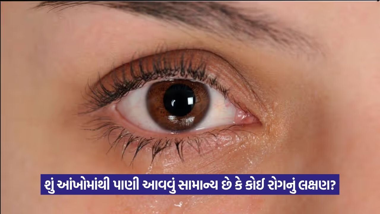શું આંખોમાંથી પાણી આવવું સામાન્ય છે કે કોઈ રોગનું લક્ષણ? અહીં જાણો સંપૂર્ણ માહિતી 21 eyes 13.jpg