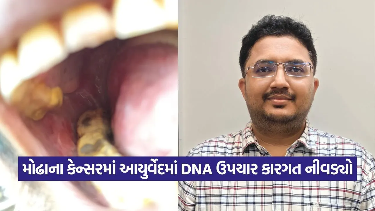 મોઢાના કેન્સરમાં આયુર્વેદમાં DNA ઉપચાર કારગત નીવડ્યો 22 dr 0309.jpg