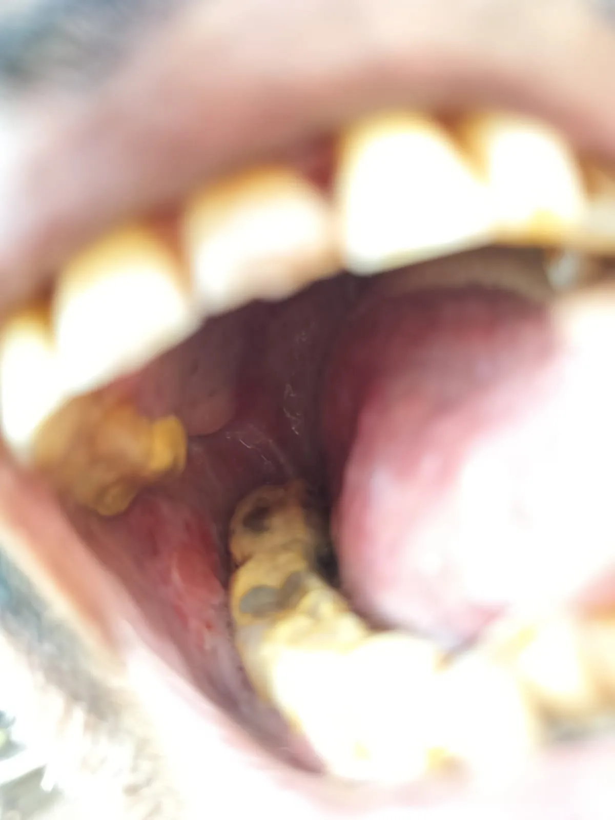 મોઢાના કેન્સરમાં આયુર્વેદમાં DNA ઉપચાર કારગત નીવડ્યો 2 WhatsApp Image 2025 09 04 at 11.03.35 AM 1.jpeg