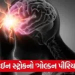 brain stroke