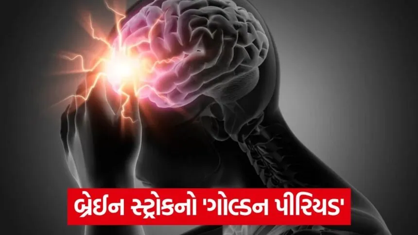 brain stroke