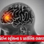 brain r3