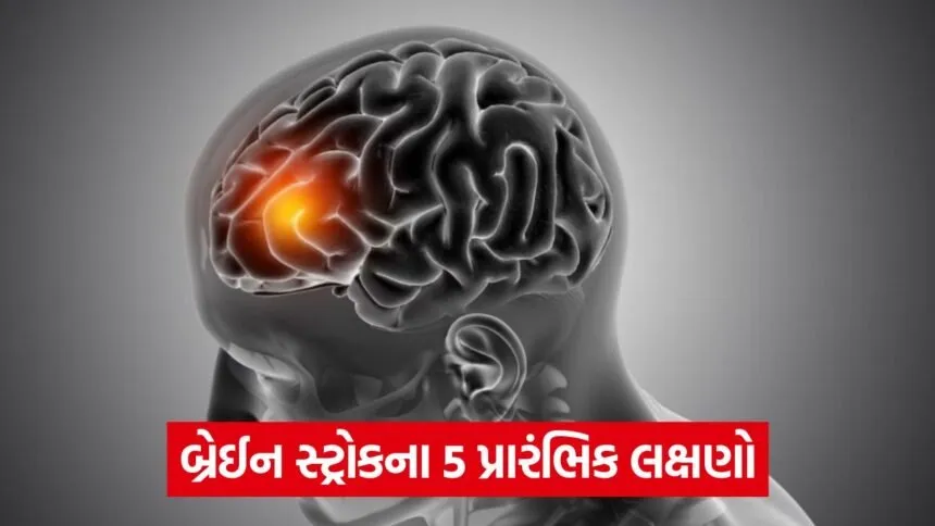 brain r3