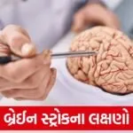 brain stroke symptoms