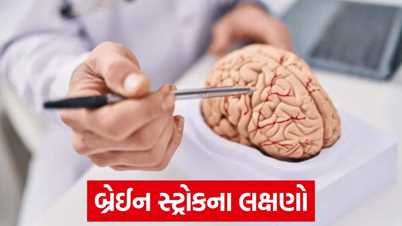 brain stroke symptoms.jpg