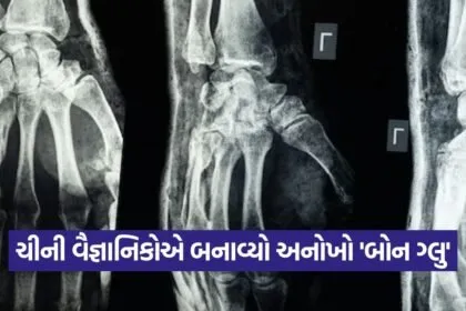 bone glue 1309