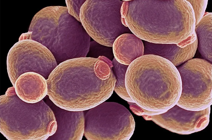 જીવલેણ ફંગલ ચેપનો અંત! ભારતમાં પહેલીવાર વિકસાવવામાં આવ્યું ખાસ મોડેલ 2 fugs.jpg