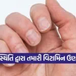 Nail 2009