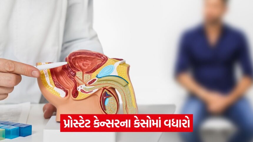 Prostate Cancer