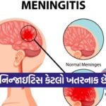 meningitis 0510