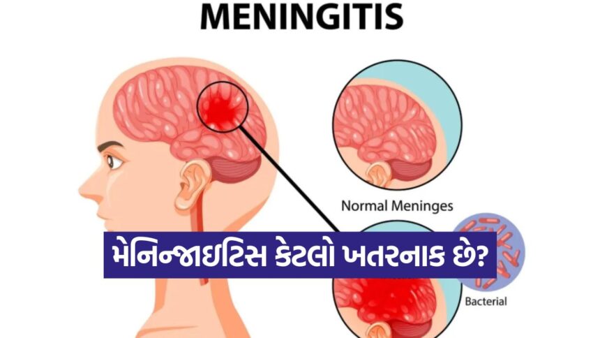 meningitis 0510