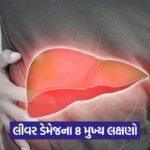 liver 34