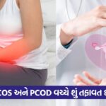 pcos 54