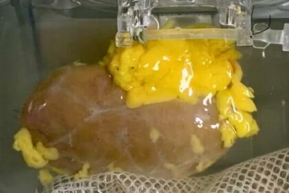 kidney