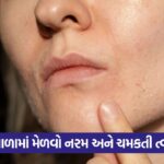dry skin 5