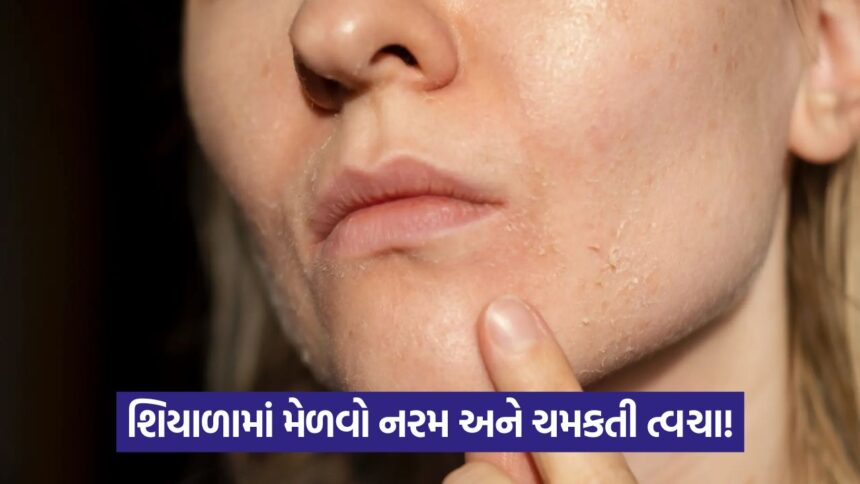 dry skin 5