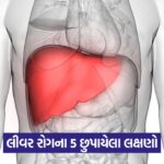 liver 654