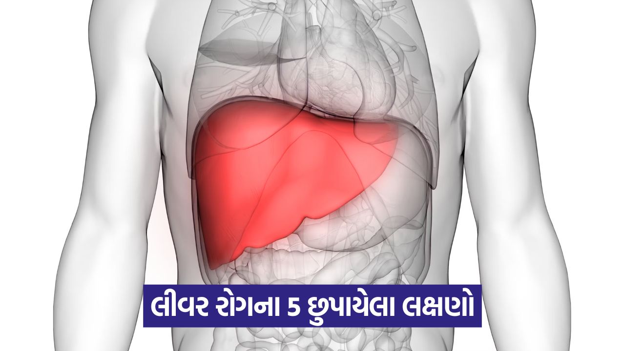 ગંભીર લીવર રોગના આ 5 લક્ષણોને અવગણશો નહીં 51 liver 654