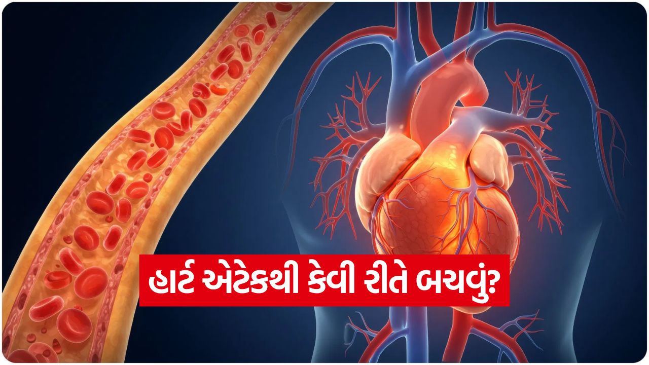 હાર્ટ એટેકનો કાયમી ઈલાજ! 49 Heart attack 2110