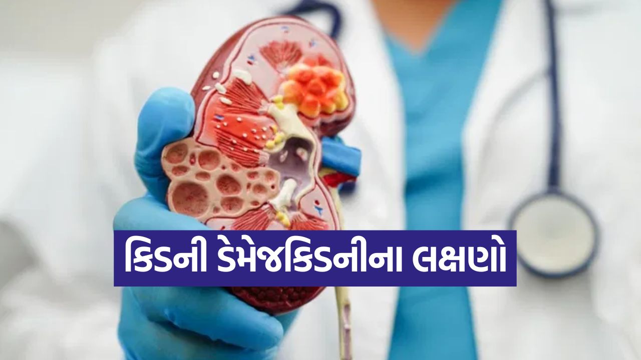કિડની ખરાબ થવાનું પહેલું સંકેત શું હોય છે? ડૉક્ટરે જણાવ્યું કિડની ડેમેજ ના લક્ષણો કેવી રીતે ઓળખવા 29 kidney