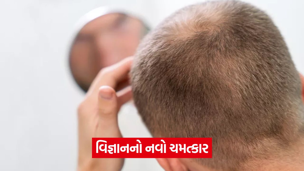 વિજ્ઞાનનો નવો ચમત્કાર: માત્ર 20 દિવસમાં વાળ ખરતા બંધ કરતું સીરમ! 33 65