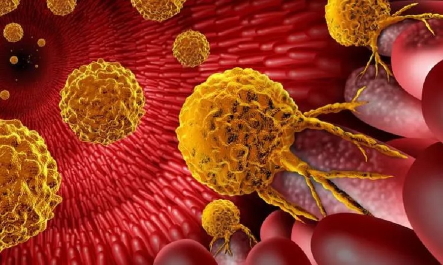 કેન્સરના કોષો જાતે જ થઈ શકે છે નષ્ટ! વૈજ્ઞાનિકોએ શોધી કાઢ્યું કે કીમોથેરાપી વિના કેવી રીતે થઈ શકે છે કેન્સરની સારવાર 2 cancer