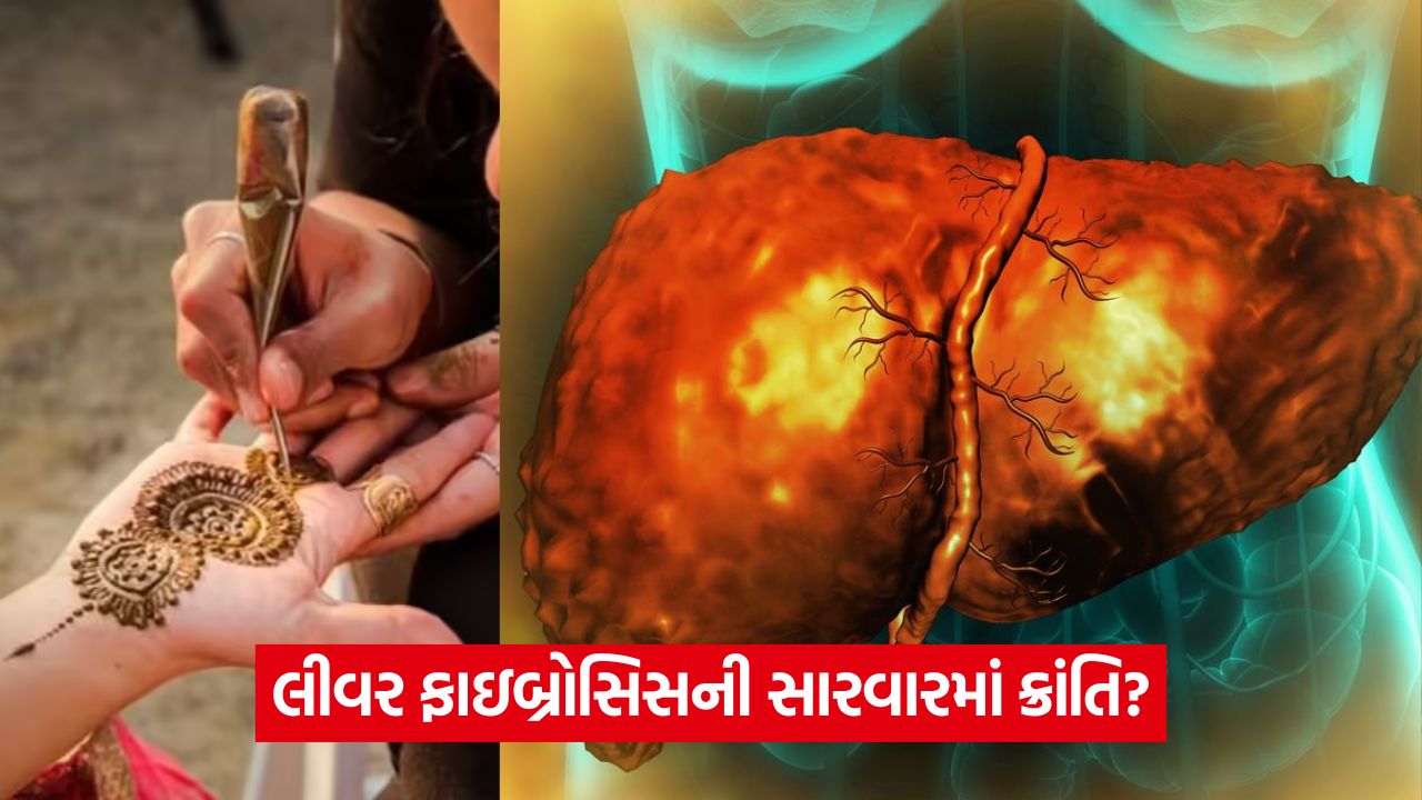લીવર ફાઇબ્રોસિસની સારવારમાં નવી આશા — મહેંદીનો રંગ બની શકે જીવનરક્ષક! 33 health 454