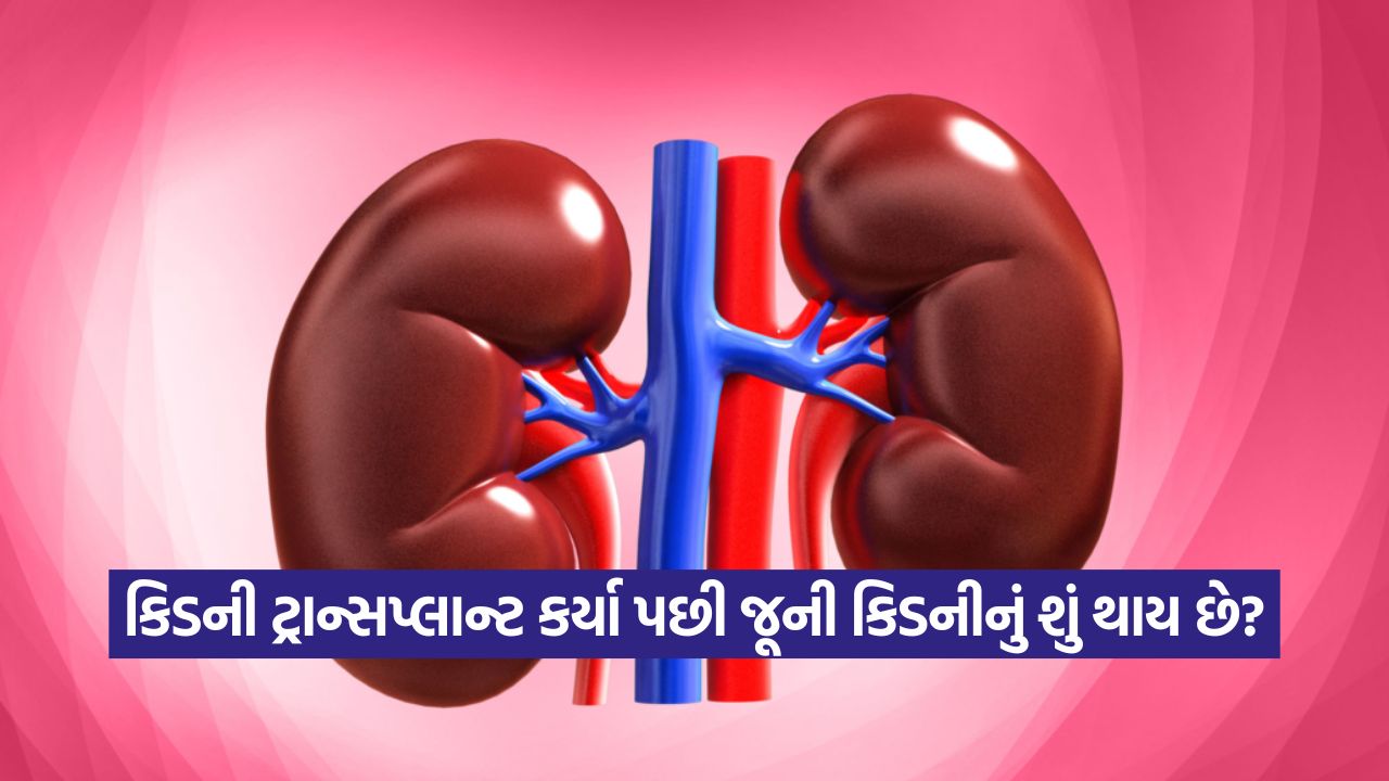 કિડની ટ્રાન્સપ્લાન્ટ પછી ત્રણ કિડની! ખરાબ કિડની ક્યારે કાઢી નાખવી પડે છે? 33 health 45 1
