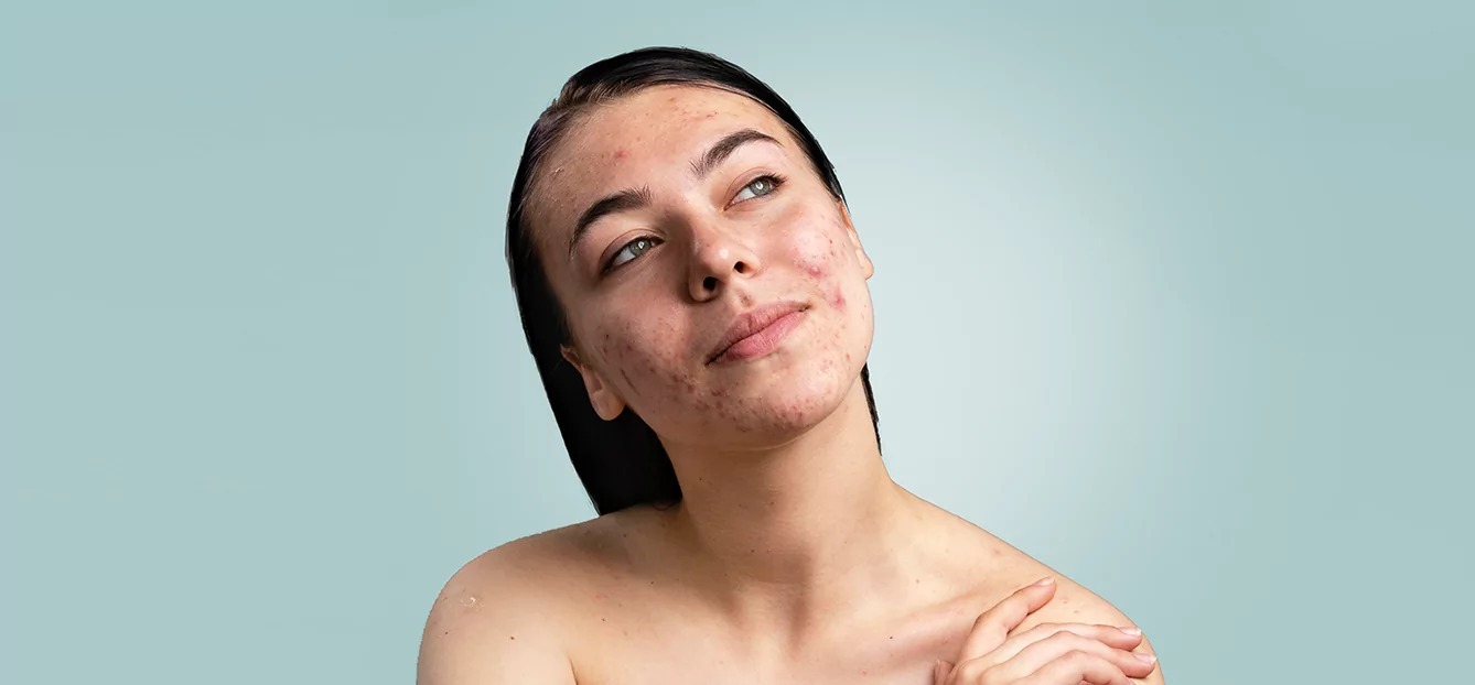 સામાન્ય સ્કીન ઇન્ફેક્શન પણ ગંભીર બની શકે: શું ફોલ્લાને દબાવવાથી મૃત્યુ થઈ શકે? 3 WhatsApp Image 2025 11 01 at 9.58.45 AM