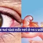 eye