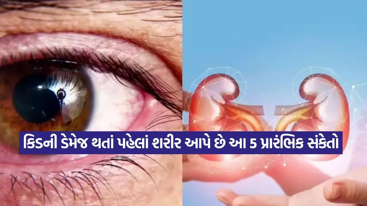 eye.jpg
