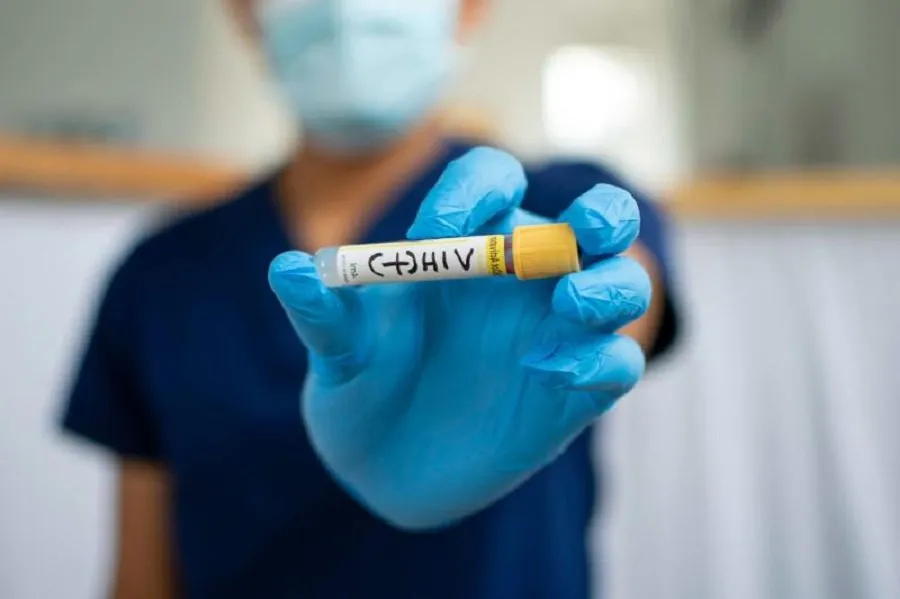 HIVનો નવો કાયમી ઇલાજ મળ્યો, હવે દવાઓથી મળશે છુટકારો! 2 HIV.jpg