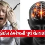 brain