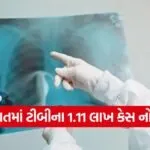 India TB situation