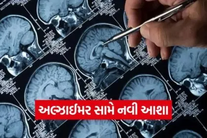 alzheimer nanoparticle therapy 1
