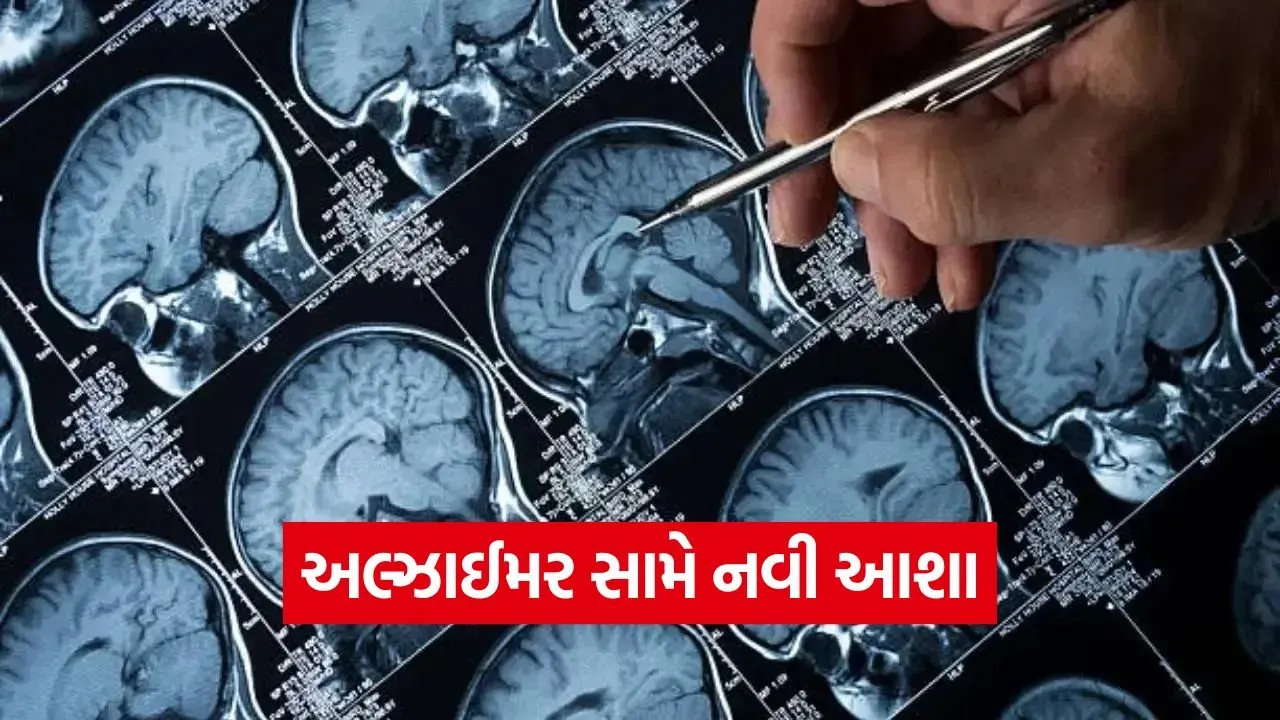 alzheimer nanoparticle therapy 1.jpg