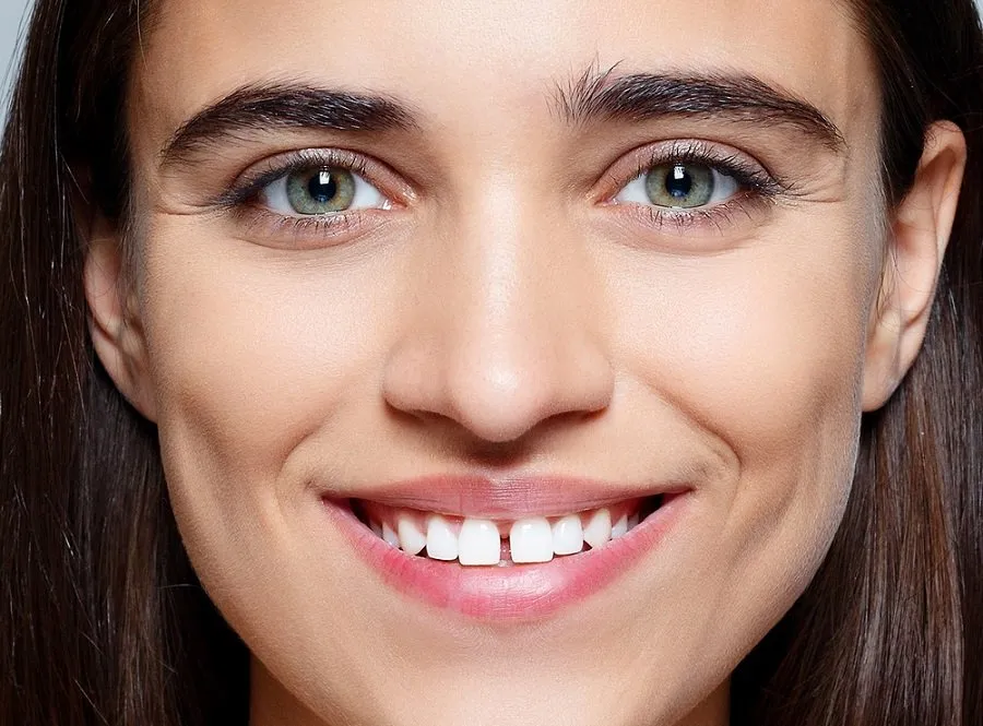 Tooth Gap