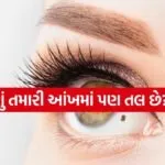 Eye Mole