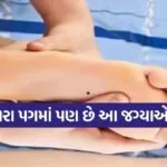 Mole on Legs