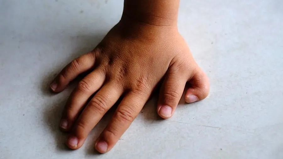 Six Fingers in Hand