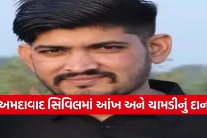 ahmedabad civil hospital eye skin donation inspiration