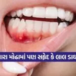 Oral 1002