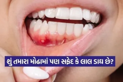 Oral 1002