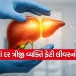 fatty liver 0303