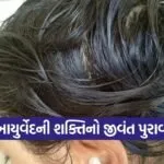 Gandhinagar Ayurveda Hair Regrowth Case 2026 1