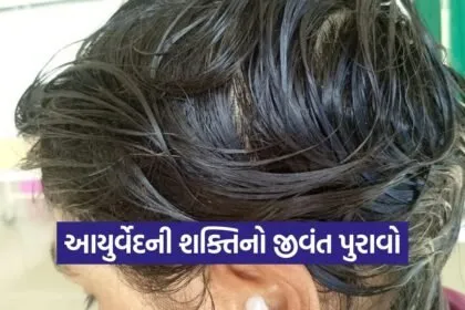 Gandhinagar Ayurveda Hair Regrowth Case 2026 1